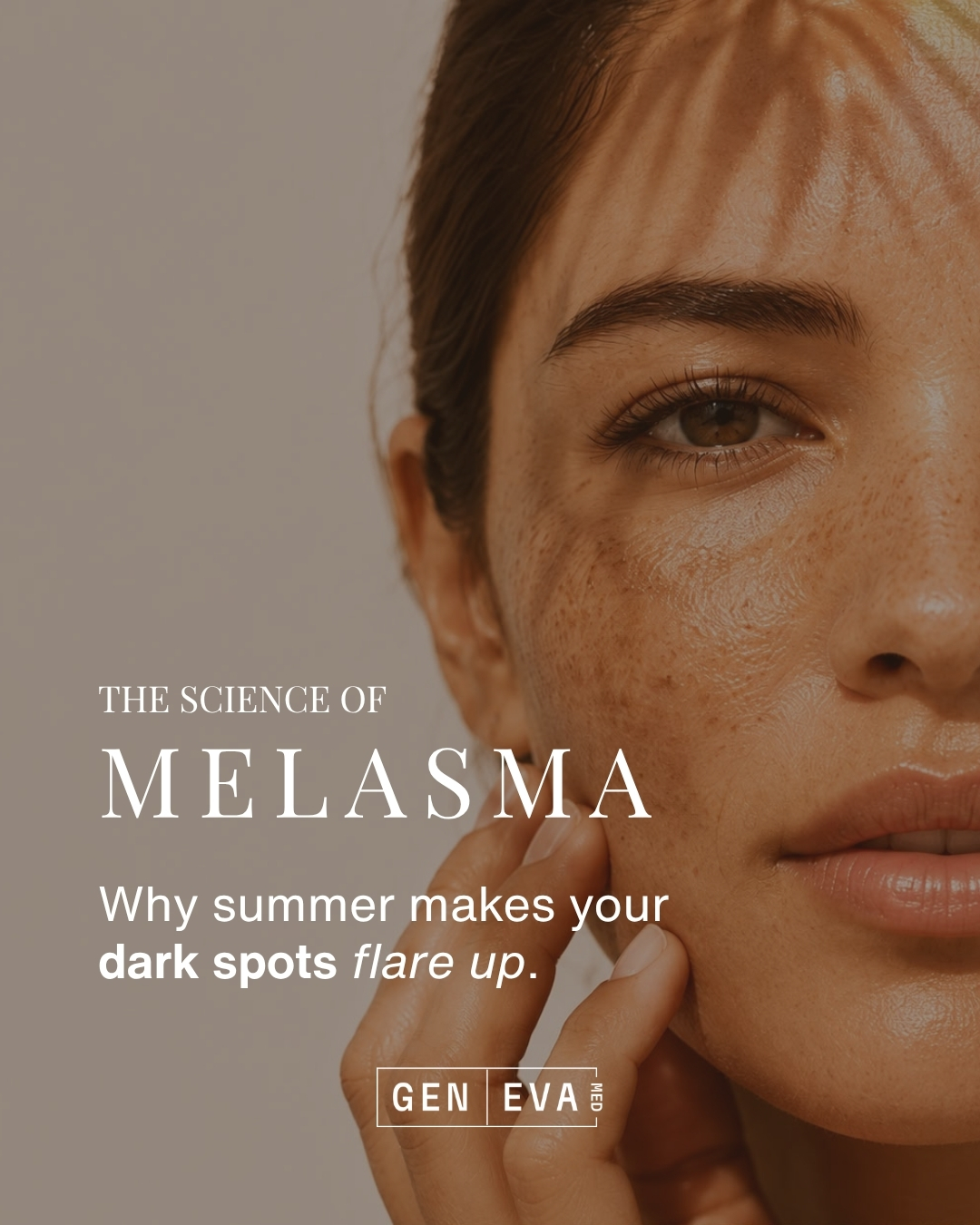 Geneva Med Instagram carousel on melasma &mdash; slide 1 of 3