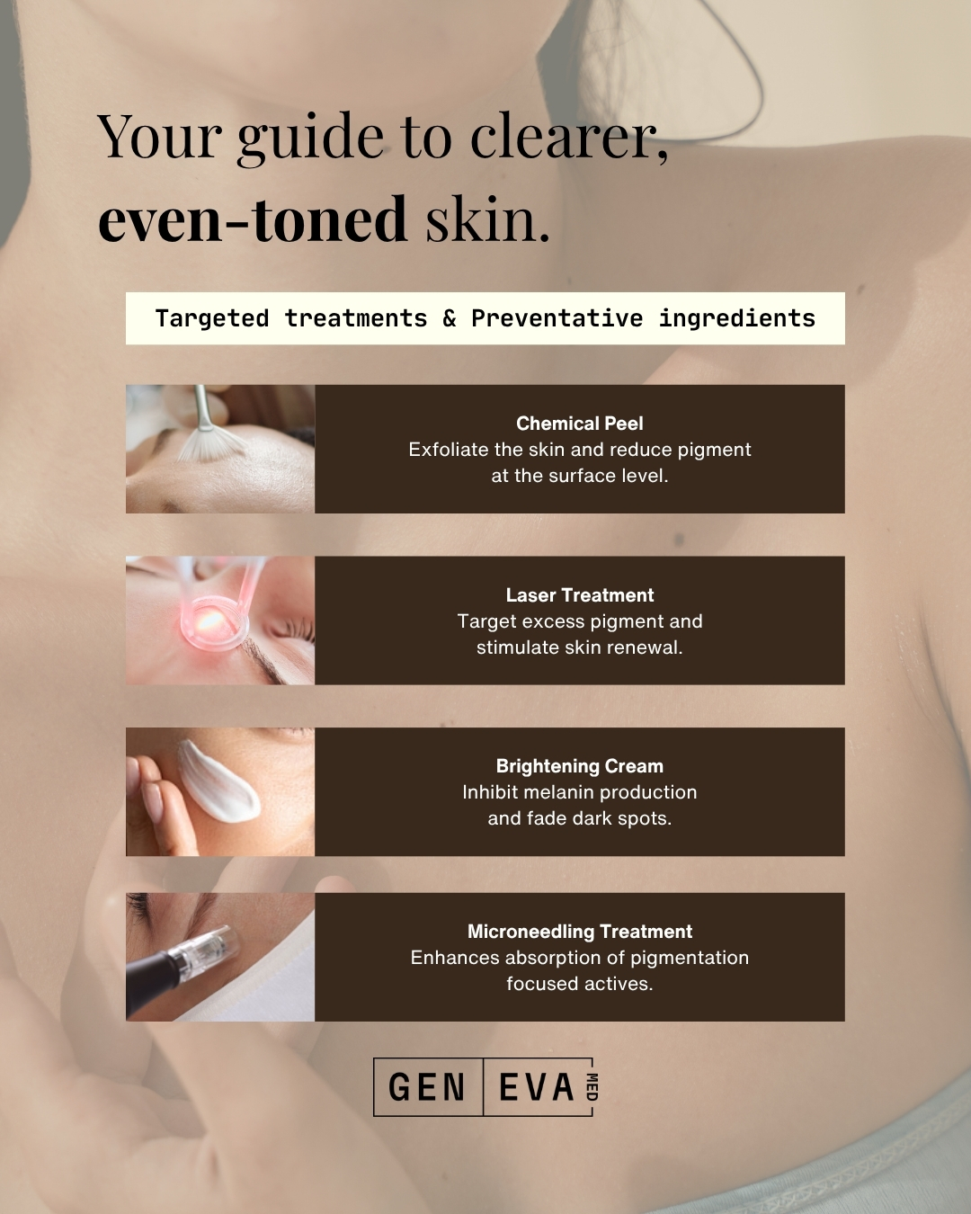 Geneva Med Instagram carousel on melasma &mdash; slide 2 of 3